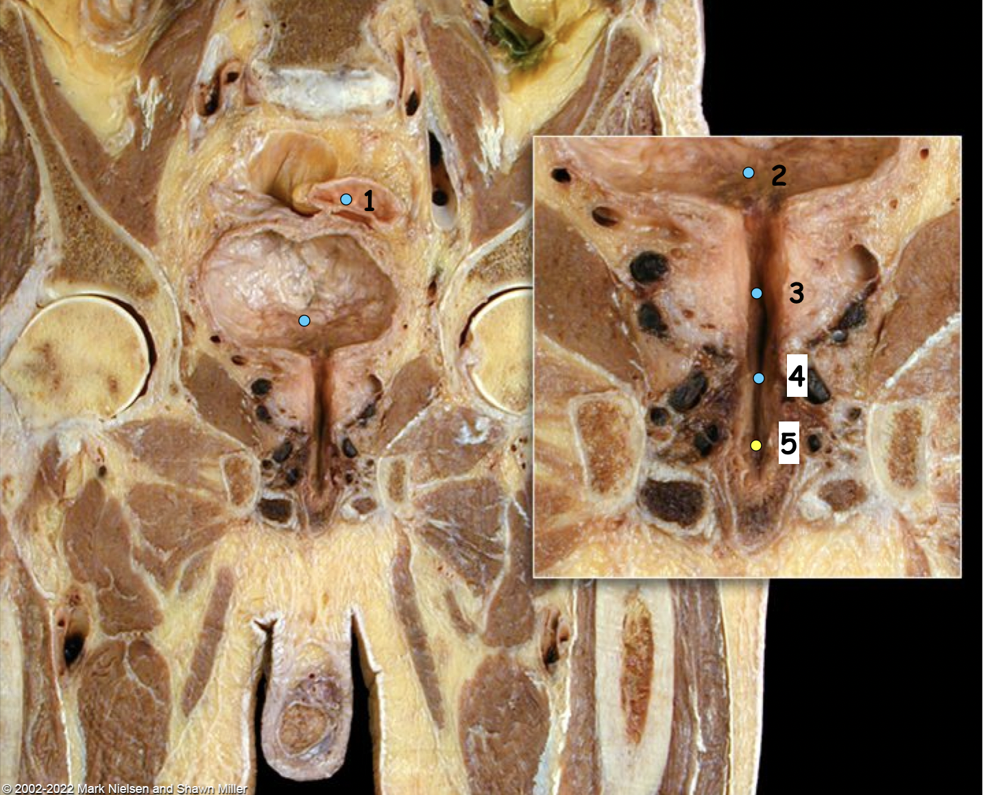 <p>What is number 5</p>