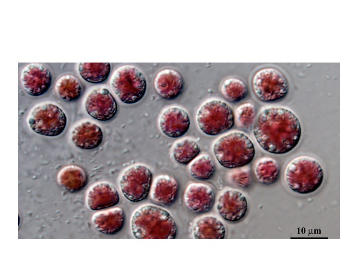 <p><span><span>To which Class does this specimen belong?</span></span></p><p><span><span>Charophyceae</span></span></p><p><span><span>Bangiophyceae</span></span></p><p><span><span>Ulvophyceae</span></span></p><p><span><span>Florideophyceae</span></span></p>