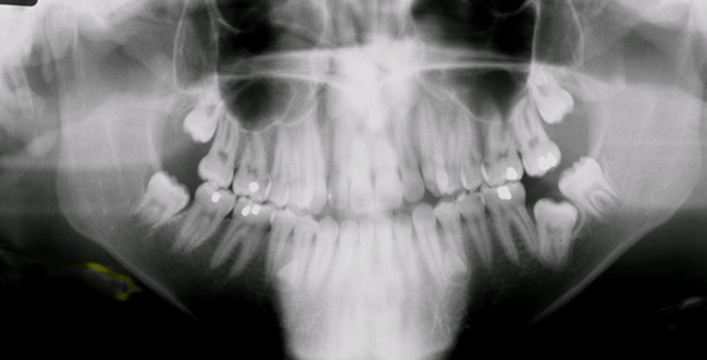 <p>allows us view your head, neck, &amp; jaw, &amp; how they work together as a whole</p>