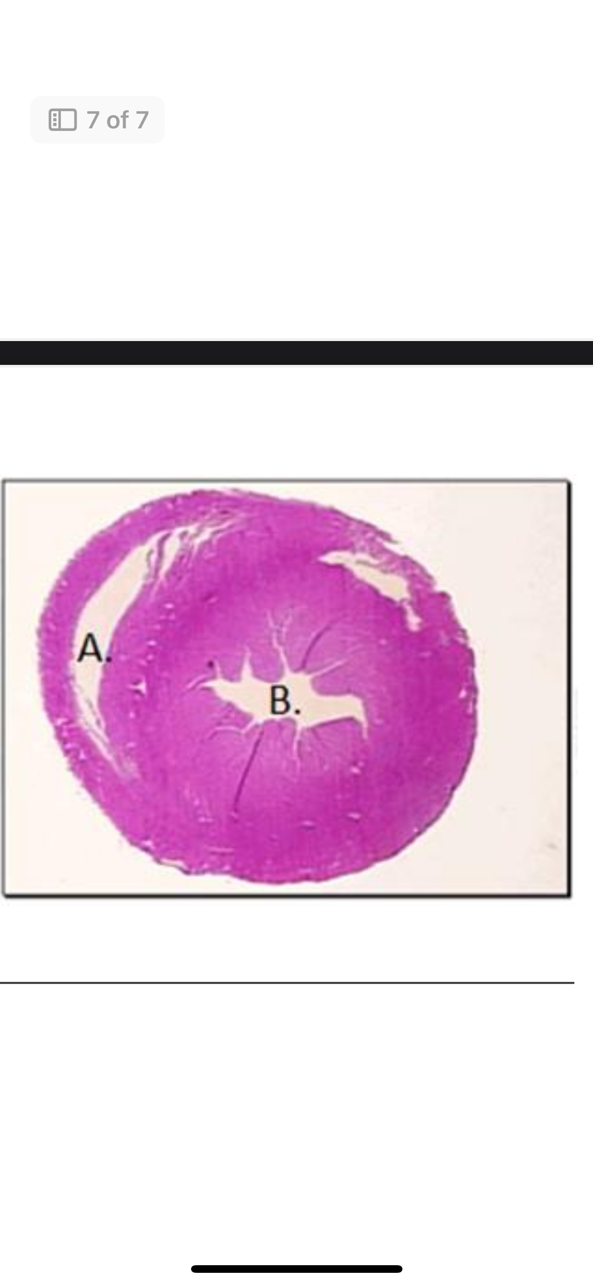 <p><span><span>Lastly, examine this transverse section of an avian heart. &nbsp;You are looking at the inside (lumen) of the left and right ventricle. &nbsp;Identify which is which:</span></span></p>