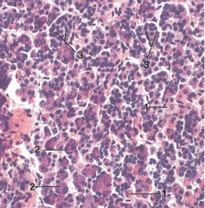 <p>3</p><p>• Chromophobes have cytoplasm that stains</p><p>very poorly</p><p>• • ? Postsecretroy acidophils and basophils</p><p>• • ? Stem cell</p>