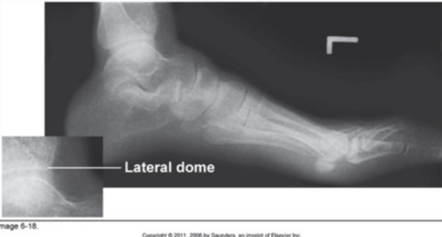 <p>Knee was elevated</p>