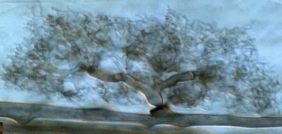 <p>is this endotrophic or ectotrophic</p>