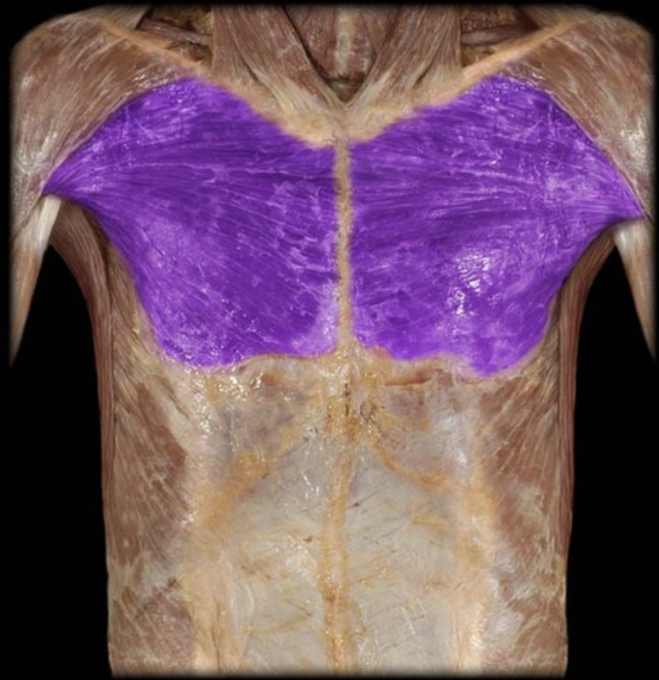 <p><em>table 3</em><br><em>I: intertubercular (bicipital) groove of humerus</em></p>