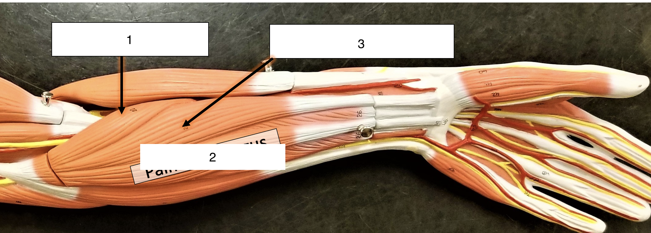 <p>name the muscle (2)</p>