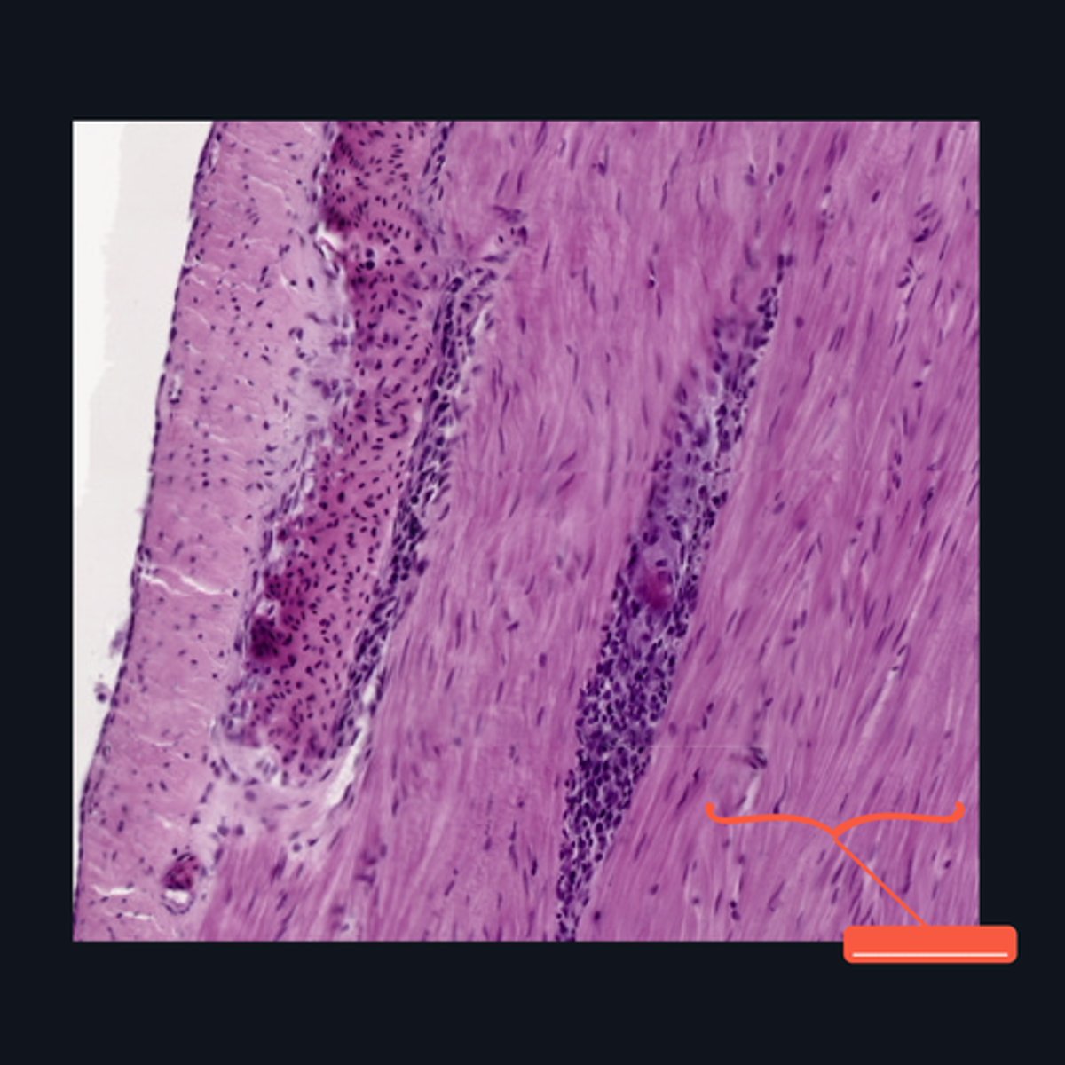 <p>Identify the structure</p>