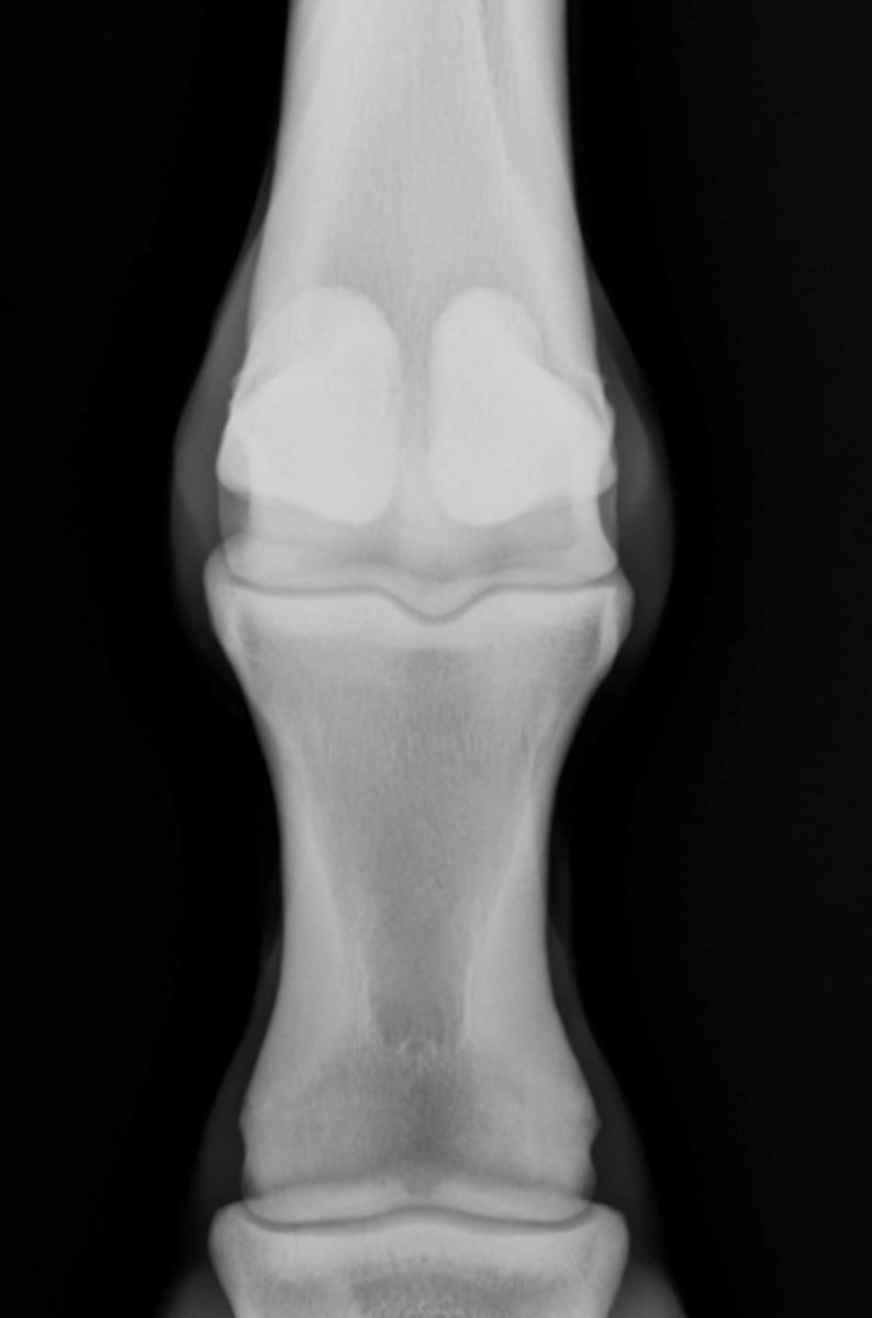 <p>What is highlighted in the DP view of the fetlock?</p>