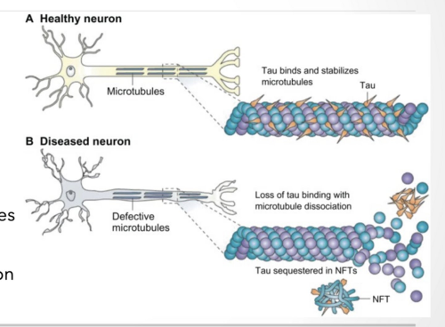 <p>Stabile microtubules are important in transport and cell division </p><p>Microtubules are rigid, hollow protein rods, roughly 25 nm in diameter, that form a key component of the eukaryotic cytoskeleton</p><p>Tau stabilizes microtubules </p><p>over phosphorylation can lead to neurodegeneration </p><p>Other molecules will cleave microtubules </p><p>These interactions can be facilitated or inhibited by post translation modification of tubulin dimer</p><p>Tubulin is building block of Microtubules</p><p>ACTIN FIBERS CAN TAKE MANY SHAPES </p><p>Actin filaments are thin and flexible </p><p>Important in cell movement and muscle contraction Lots of proteins regulate actin structure and polymerization</p>