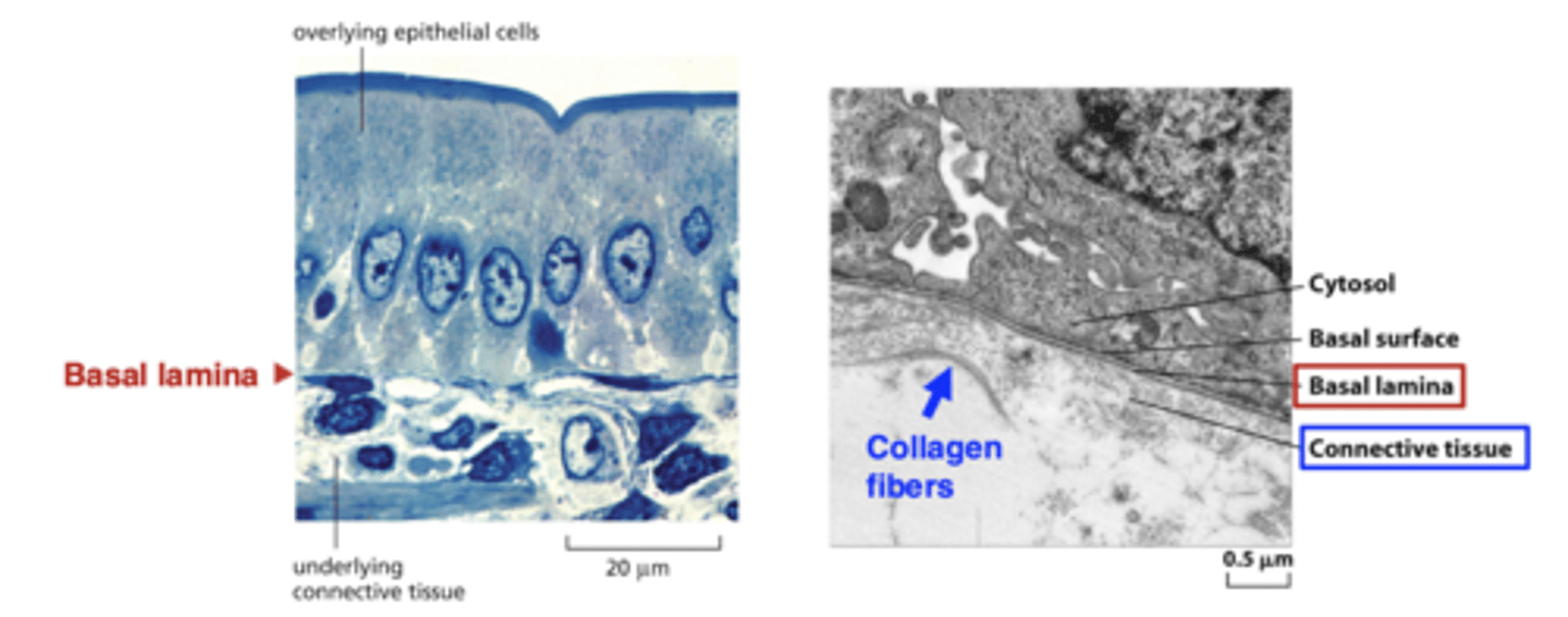 <p>isolated cells, with a large amount of ECM</p>