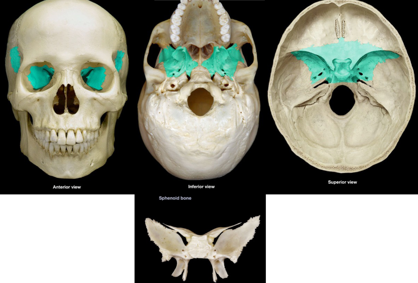 <p>butterfly-shaped bone at the base of the skull (behind eye socket)</p>