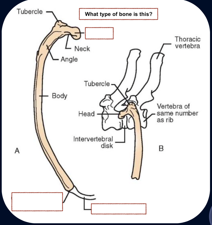 <p>Costal cartilage</p><p>Costochondral junction</p><p>Head</p><p>Manubrium </p><p>Xyphoid</p><p>Sternebrea</p>