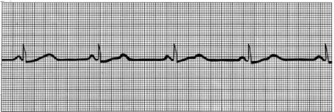 <p>(rate is too slow)</p>