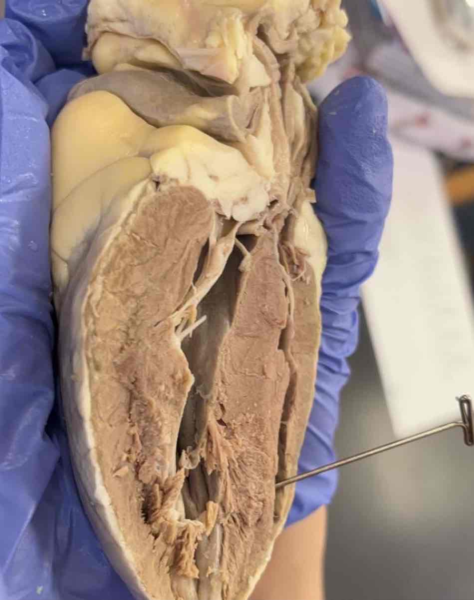 <p>Which cavity of the heart is this?</p>