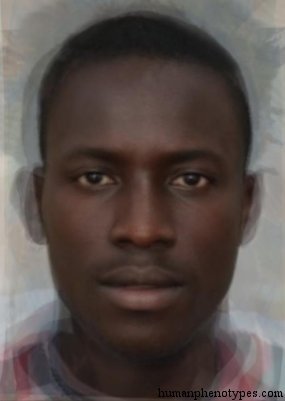 <p>Identify this Phenotype</p>