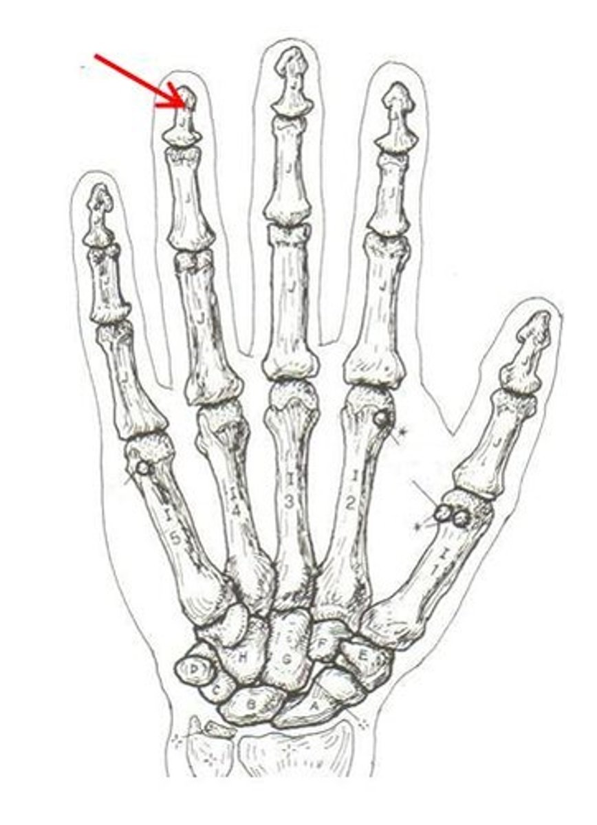 <p>ID bone</p>