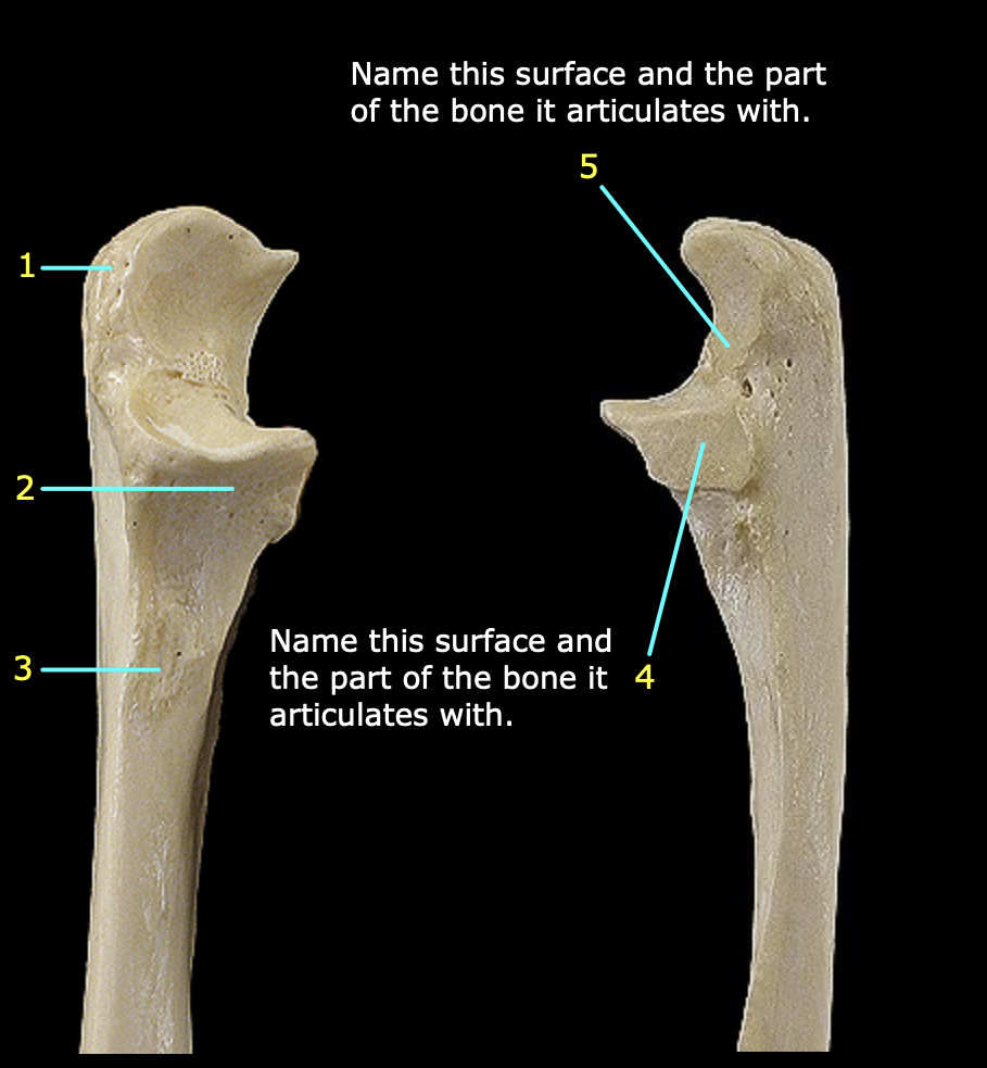 <p>What bone is this? What structure is 1?</p>