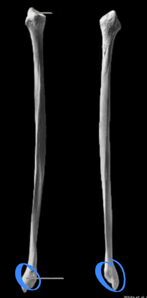 <p>Attachment for ankle ligature</p>