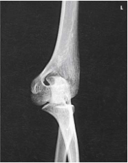 <p>What projection, position, and anatomy is this?</p>