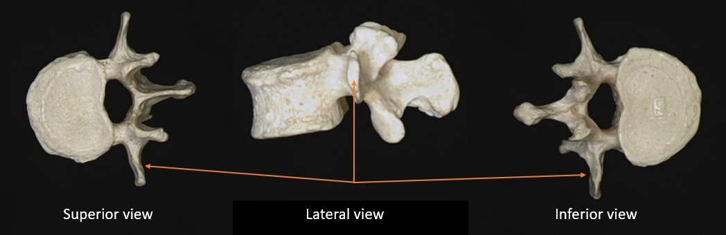 transverse  process 