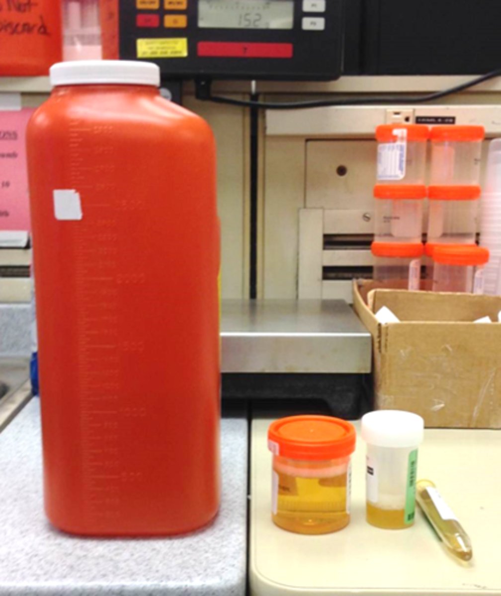 <p>What is this object's function?</p>