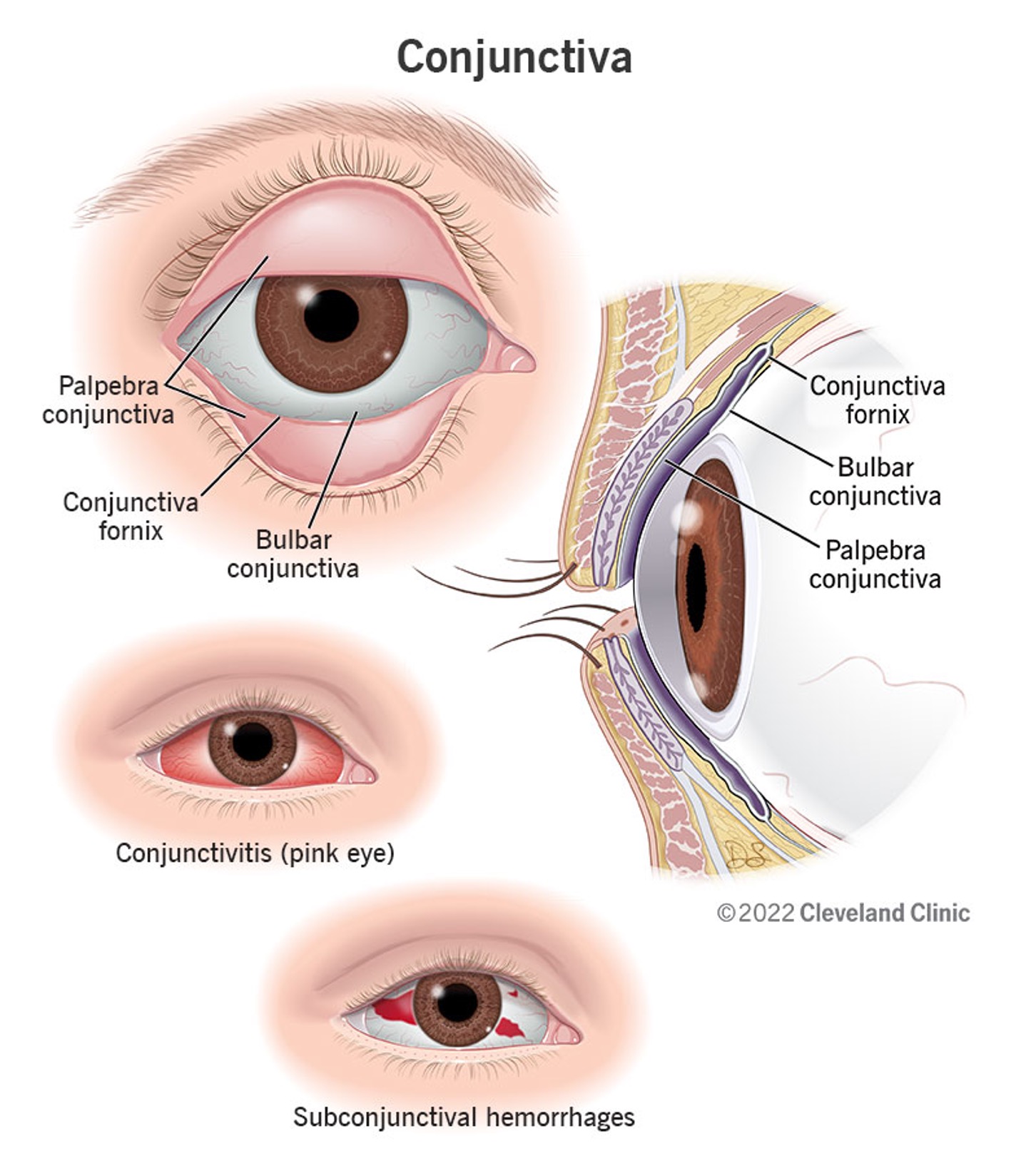 <p>starts at the mucocutaneous junction and lines the eyelids </p>