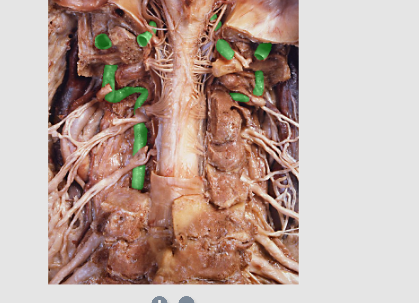 <p>Which artery is this?</p>