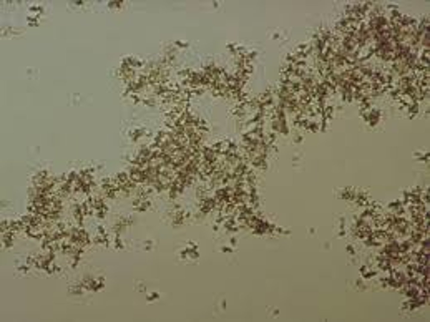 <p>- Acid pH urine &lt;5.5</p><p>- Brick dust or yellow brown color</p><p>- Can occur in clumps or resemble that of debris or granular casts attached to other sediment structures.</p><p>- Refrigeration causes a very characteristic pink sediment color in the samples</p>