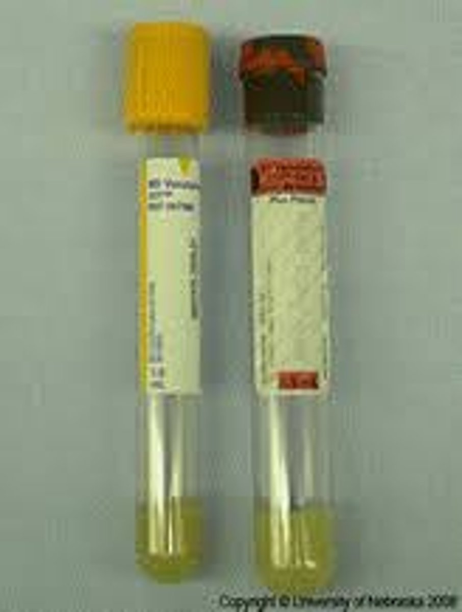 <p>C. CORRECT. When collecting a specimen for an SST, the medical assistant should let the tube stand for 45 min prior to centrifuge.</p><p>A. When collecting a specimen for an SST, 60 min exceeds the maximum limit of time the tube should stand prior to centrifuge.</p><p>B. When collecting a specimen for an ST, 15 min is an insufficient length of time for the tube to stand prior to centrifuge.</p><p>D. When collecting a specimen for an ST, 20 min is an insufficient length of time for the tube to stand prior to centrifuge.</p>