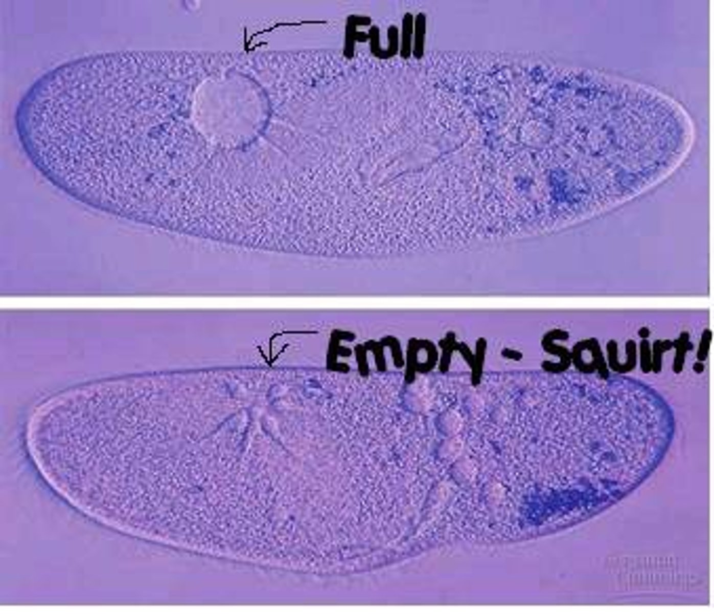 <p>saclike organelles that expand to collect excess water and contract to squeeze the water out of the cell</p>