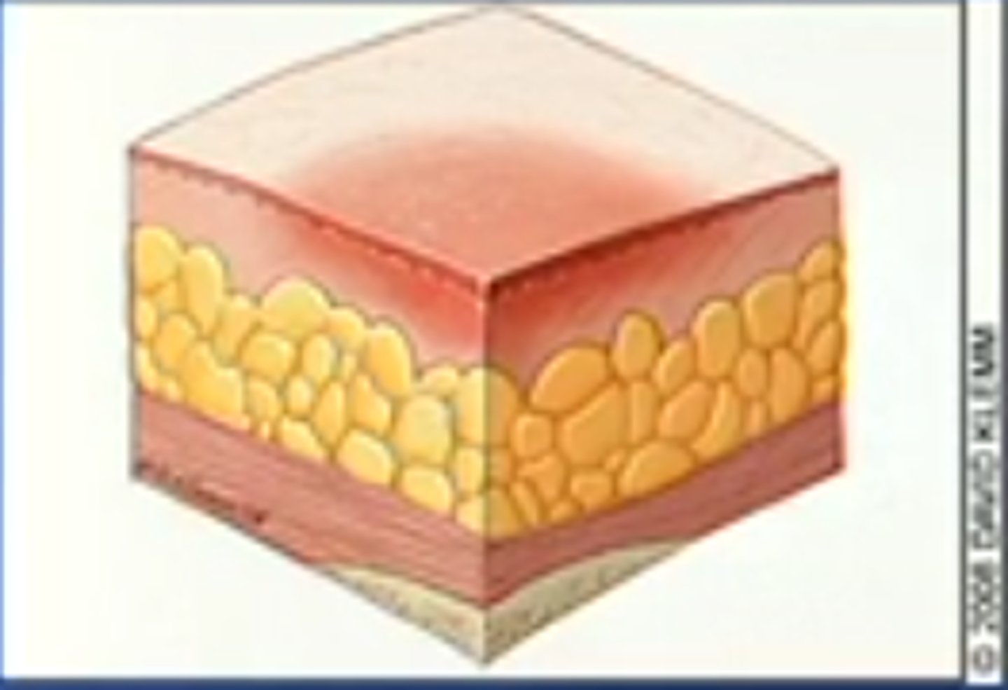 <p>nonblanchable erythema of intact skin</p>