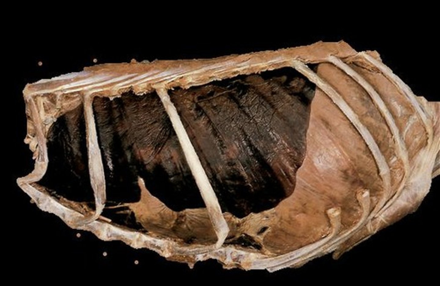 <p>Space housing lungs, heart, and major vessels.</p>