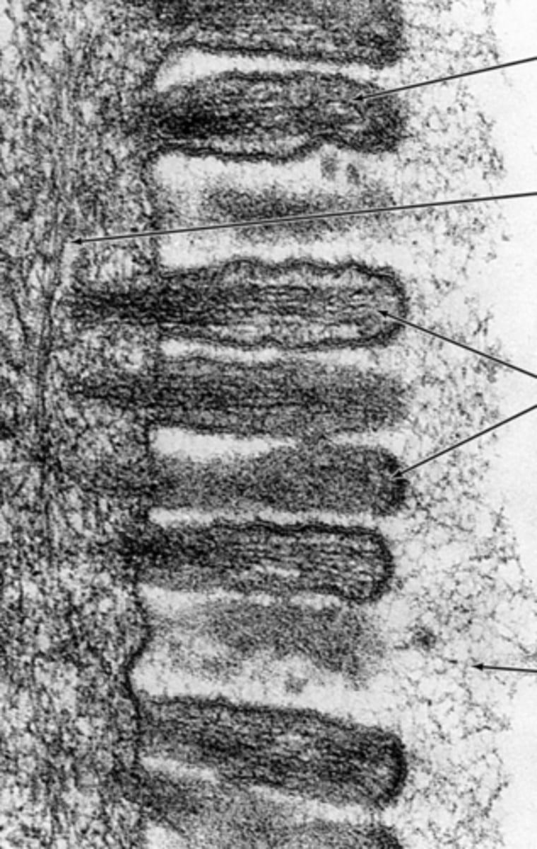 <p>Identify the apical membrane modification demonstrated in the EM</p>