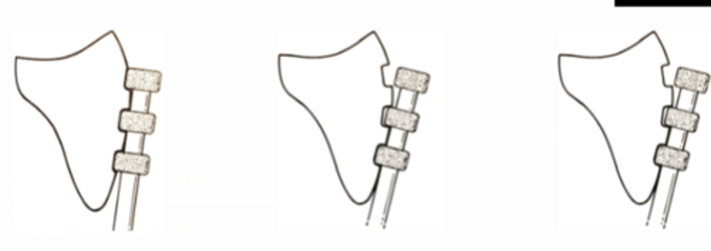 <p>When using a depth cutter, to reach the necessary depth in Cervical and incisal thirds, the bur should be used in __ different angulations/planes</p>