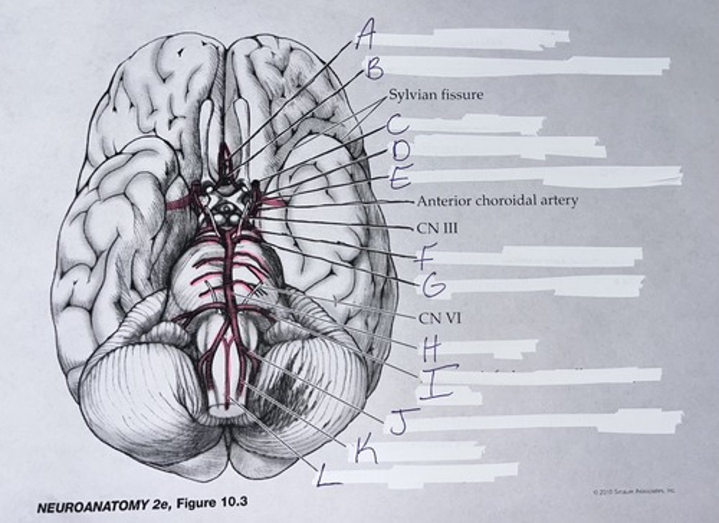 <p>A = ACA (anterior cerebral artery)</p><p>B = AComm (anterior communicating)</p><p>C = internal carotid</p><p>D = MCA (middle cerebral artery)</p><p>E = PComm (posterior communicating)</p><p>F = PCA (posterior cerebral artery)</p><p>G = SCA (superior cerebellar artery)</p><p>H = basilar artery</p><p>I = AICA (anterior inferior cerebellar artery)</p><p>J = PICA (posterior inferior cerebellar artery)</p><p>K = vertebral artery</p><p>L = anterior spinal artery</p>