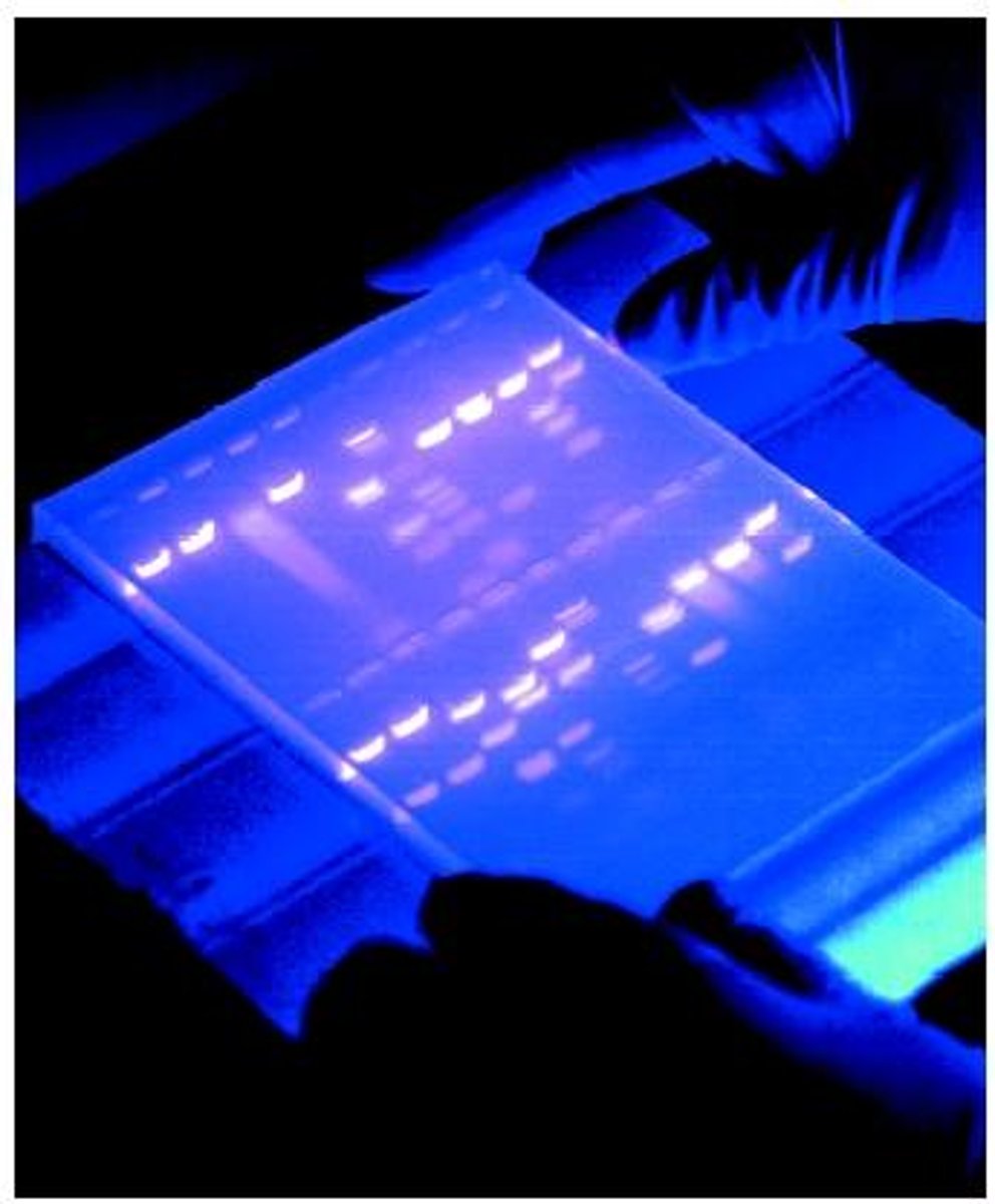 <p>A process where DNA fragments are separated according to size using electrical charges</p>
