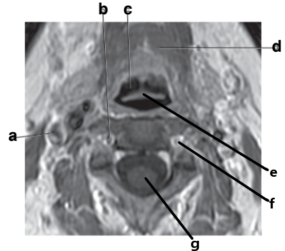 <p>What is letter e?</p>