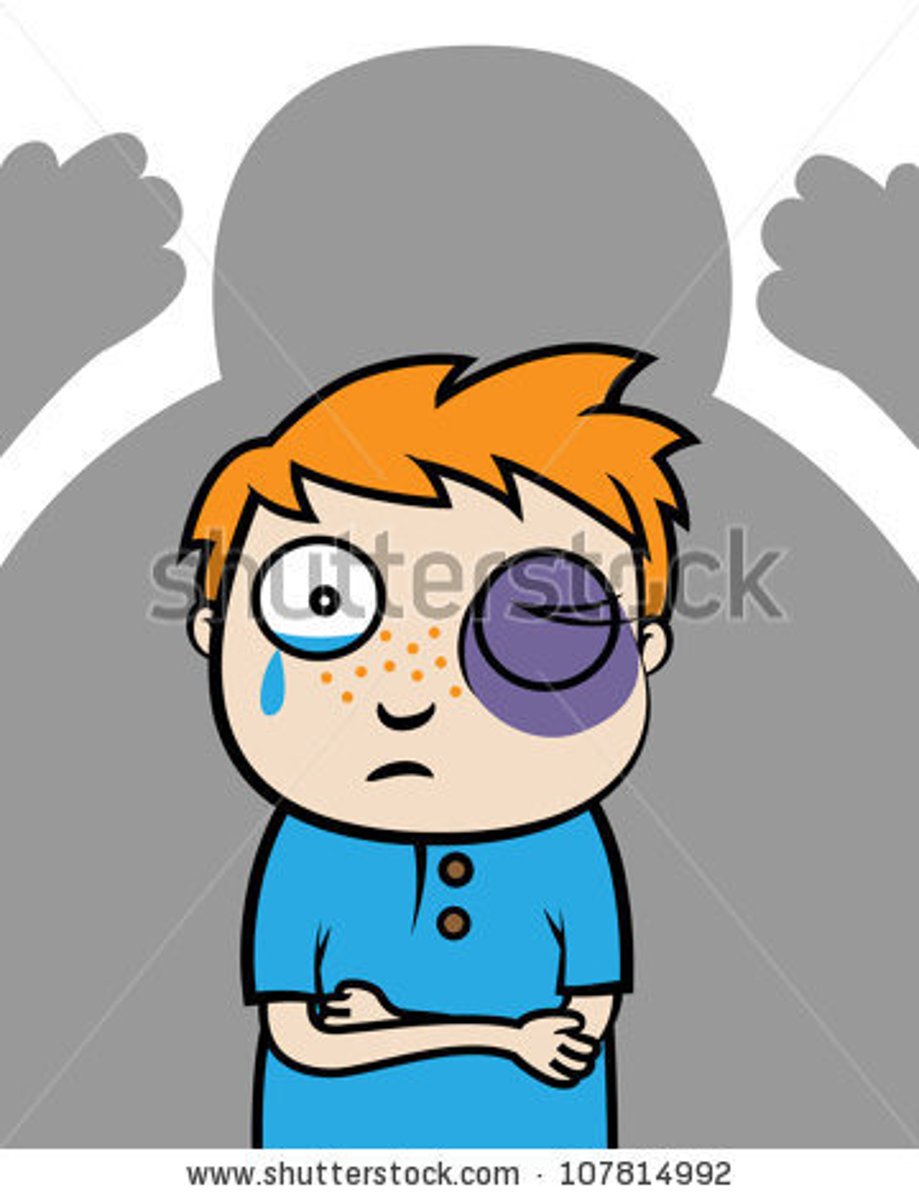 <p>bí qīng liǎn zhǒng <br>with a bloody nose and a swollen face</p>