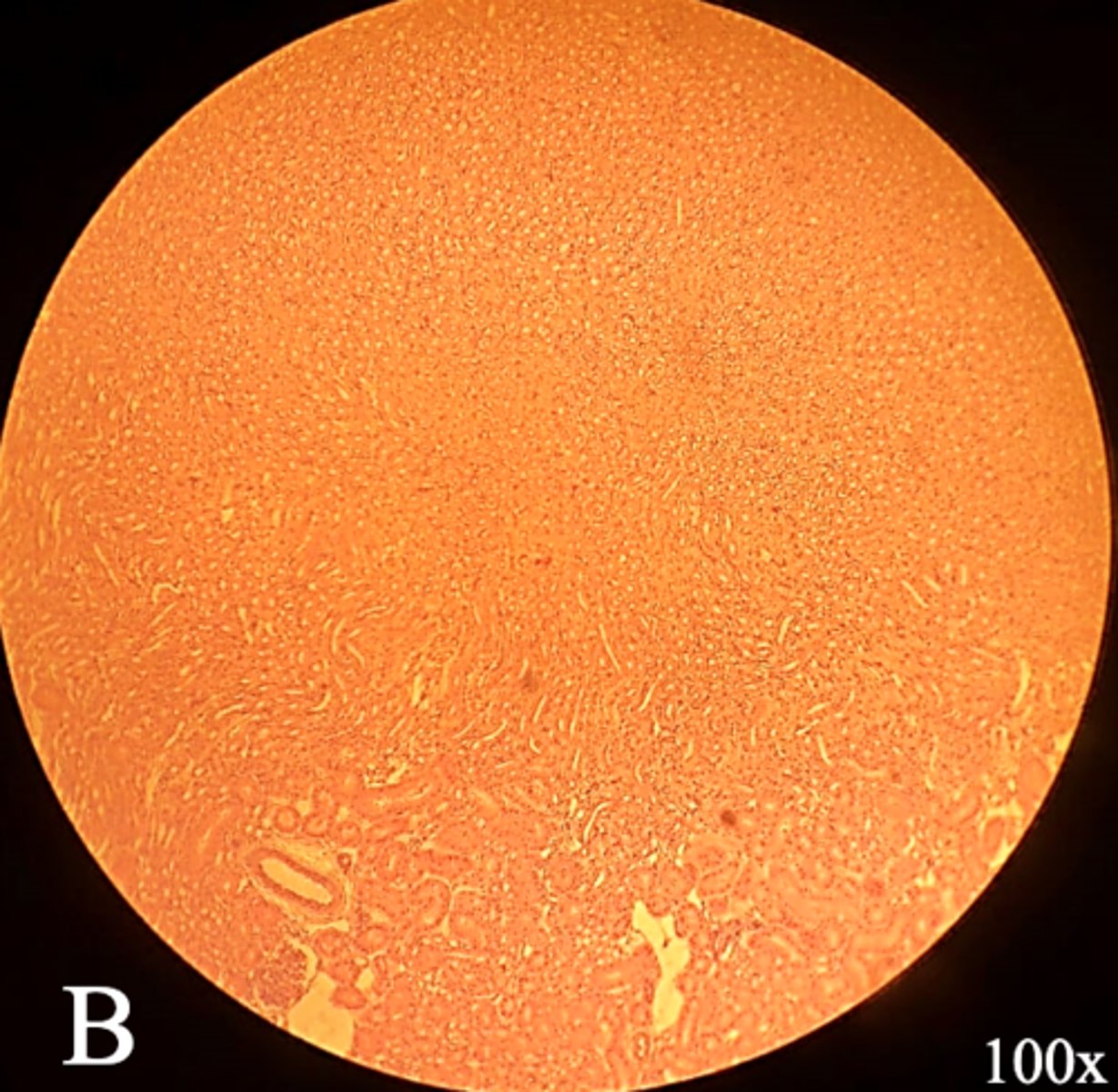 <p>name the region of kidney</p>