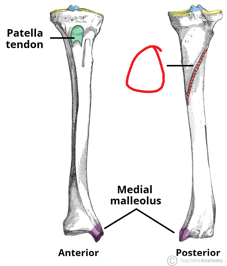 <p>Origin: soleus (partial)</p><p class="has-focus">Insertion: popliteus (posterior surface of tibia, superior to line)</p>