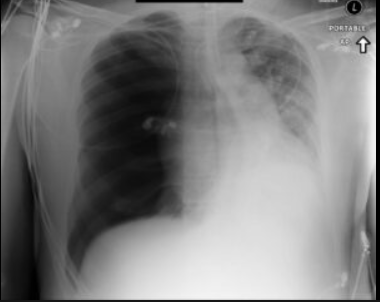 <p>Why should you never see a radiograph that looks like this?</p>