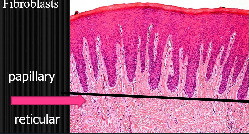 <ul><li><p>Mucous membrane (stratified squamous epithelium)</p><ul><li><p>Sublingual mucosa has thinnest epithelium for drug delivery</p></li></ul></li><li><p>May be orthokeratinized (full; cells with no nucleus), parakeratinized (partial; some cells with no nucleus) or non-keratinized</p></li><li><p>Has underlying lamina propria to protect submucosa (basement lamina may exist separating epithelium and lamina propria)</p><ul><li><p>Papillary layer - Under epithelium with loose CT</p><p>Reticular layer - Under papillary layer with dense CT</p></li></ul></li><li><p>May have keratohyaline granules (deeply stained in cytoplasm)</p></li><li><p>Lack of Langerhans cells make mucosa susceptible to allergens (tonsils in mouth compensate for this)</p></li></ul><p></p>