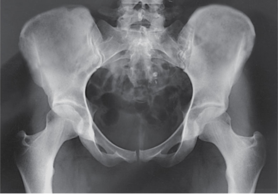 <p>What is the projection and anatomy shown in this image?</p>