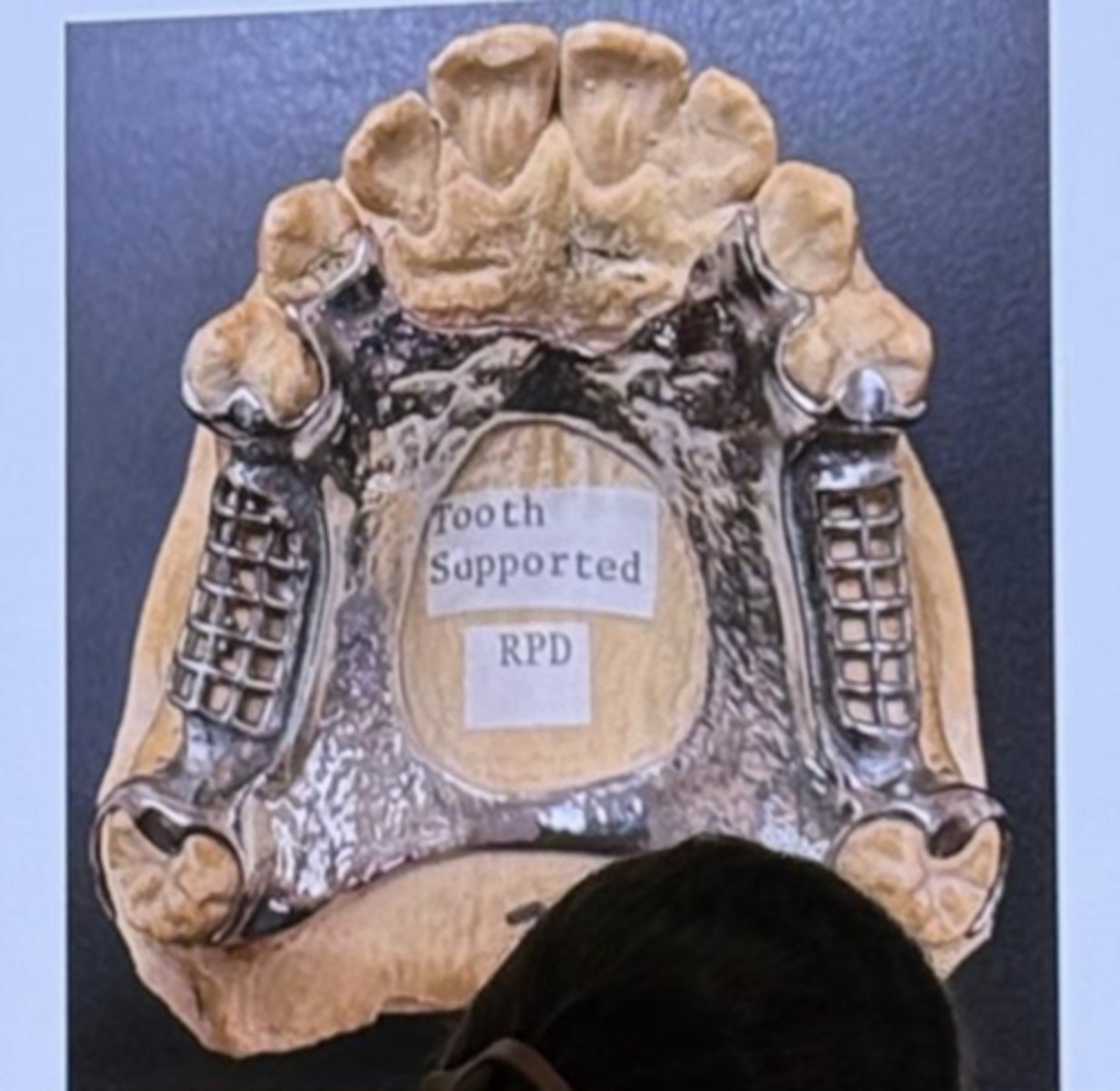 <p>A. Both statements are correct</p>