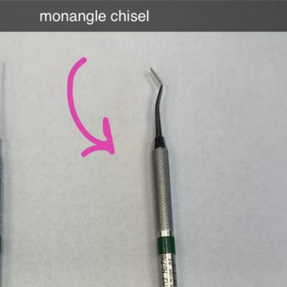 <p>MONANGLE CHISTLE</p>