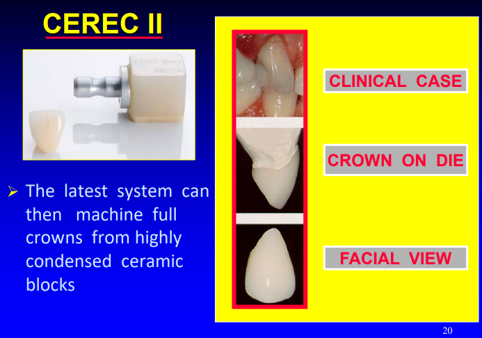 <p>CEREC II </p>