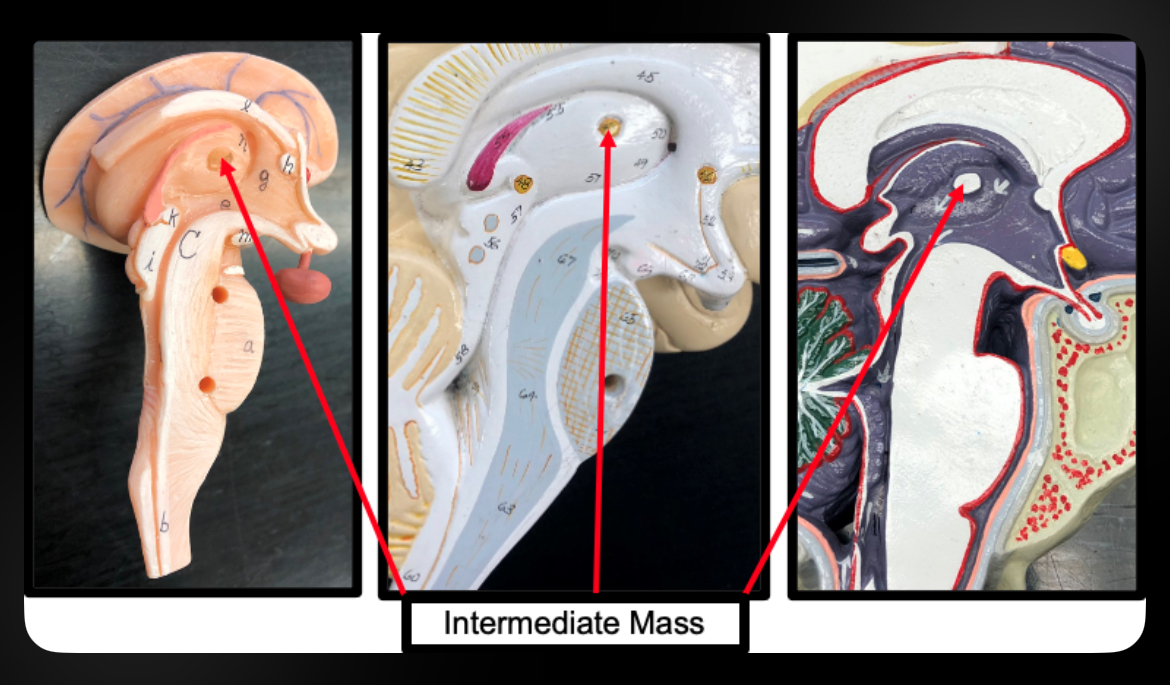 <p>Intermediate Mass</p>