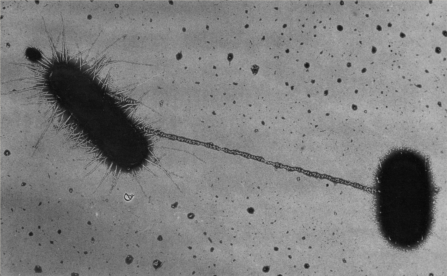 <p>The micrograph below shows cells engaging in ______ gene transfer via _____. Select one: a. horizontal, transduction b. horizontal, conjugation c. vertical, transformation d. vertical, conjugation e. horizontal, transformation f. vertical, transduction</p>