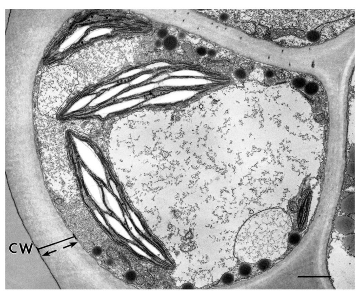 <p>rovides tensile strength and protection against mechanical and osmotic stress </p><p>allows cells to develop turgor pressure, which is the pressure of the cell contents against the cell wall.</p>