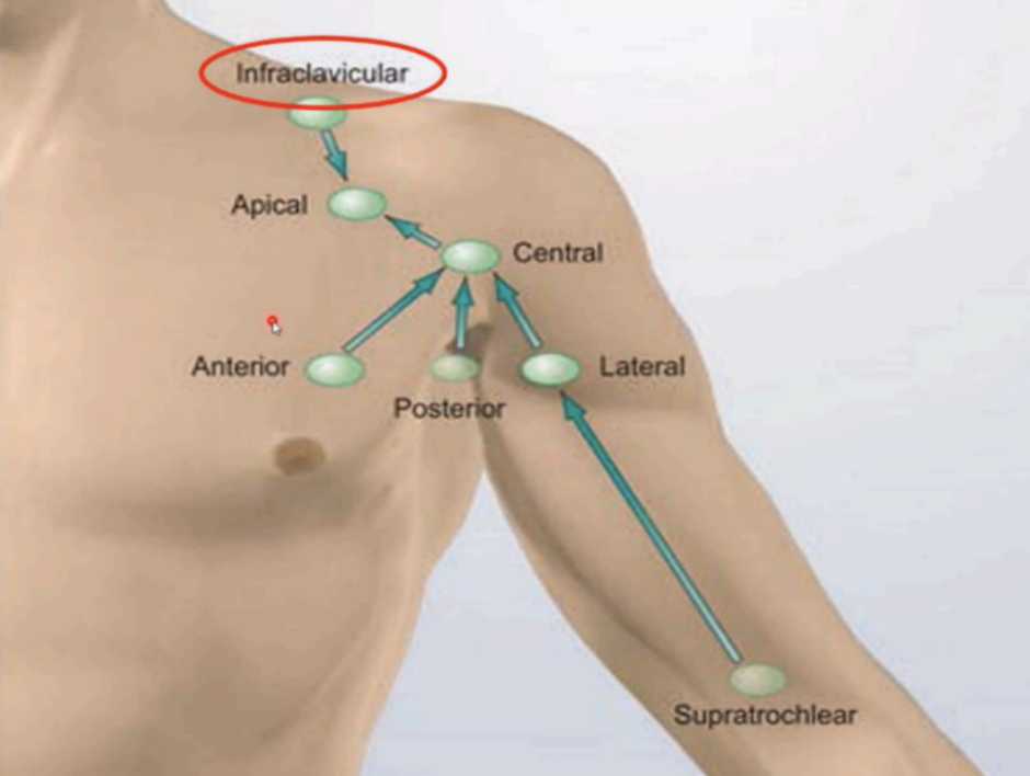<p>Just .. remember the direction of how lymph flows</p>