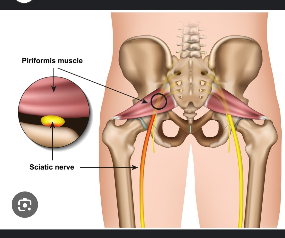 <p>Where does the preforms originate from?</p>